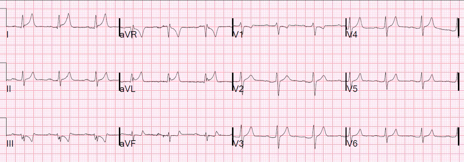 Royals lead the nation in sending good luck messages to the Lionesses ...